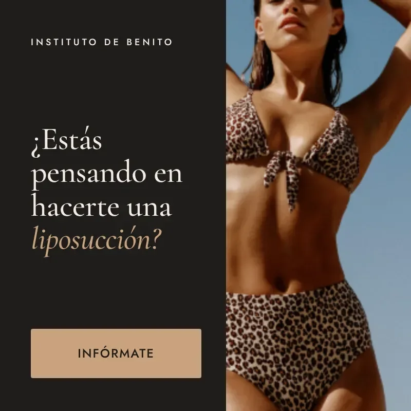 Liposucción en Instituto de Benito: infórmate