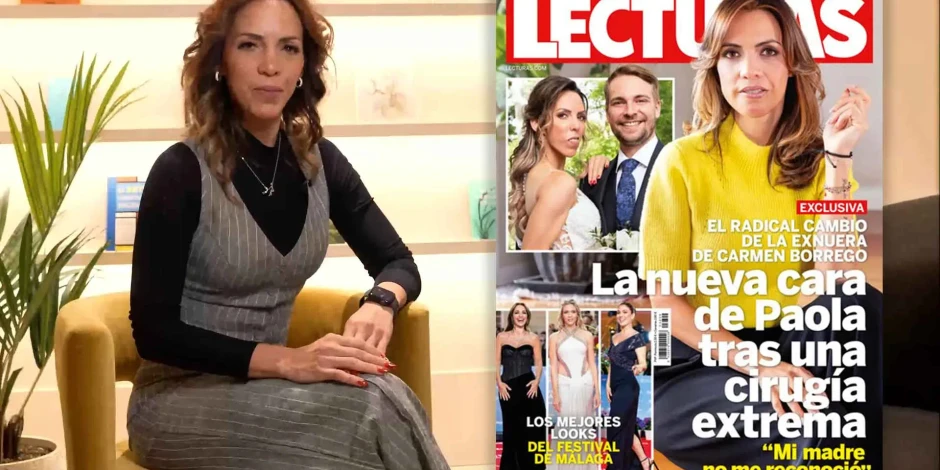 Así ha cambiado el rostro de Paola Olmedo: el tratamiento del Dr. Sada